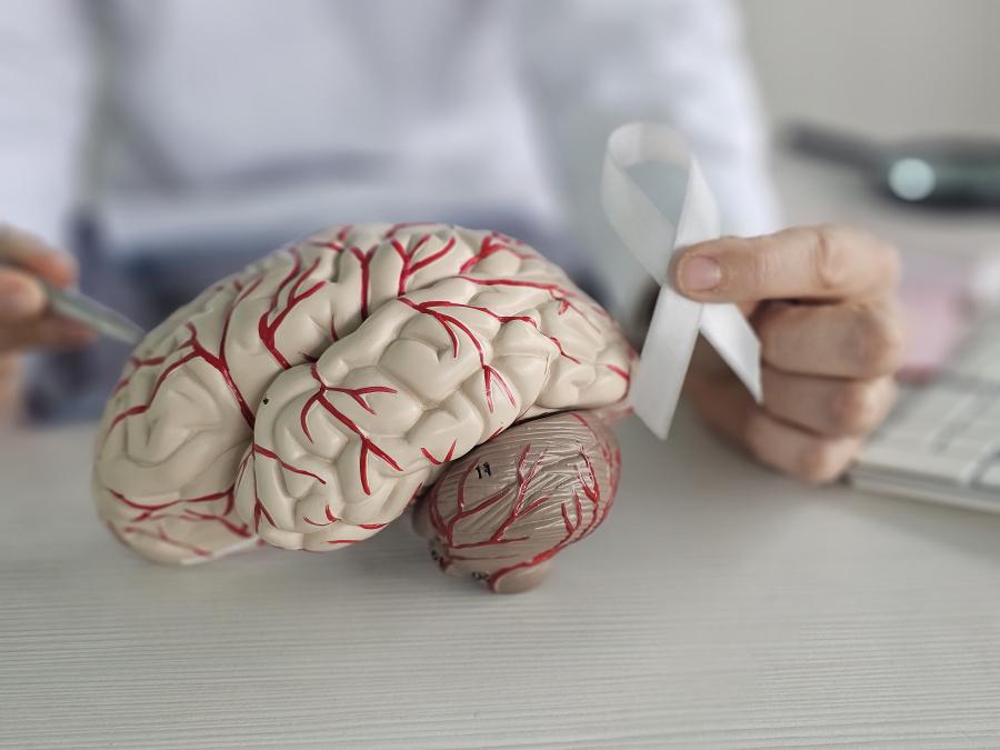 Повторный инсульт