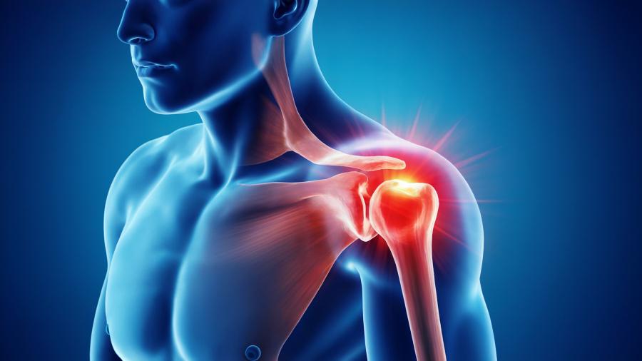 Вывих плеча