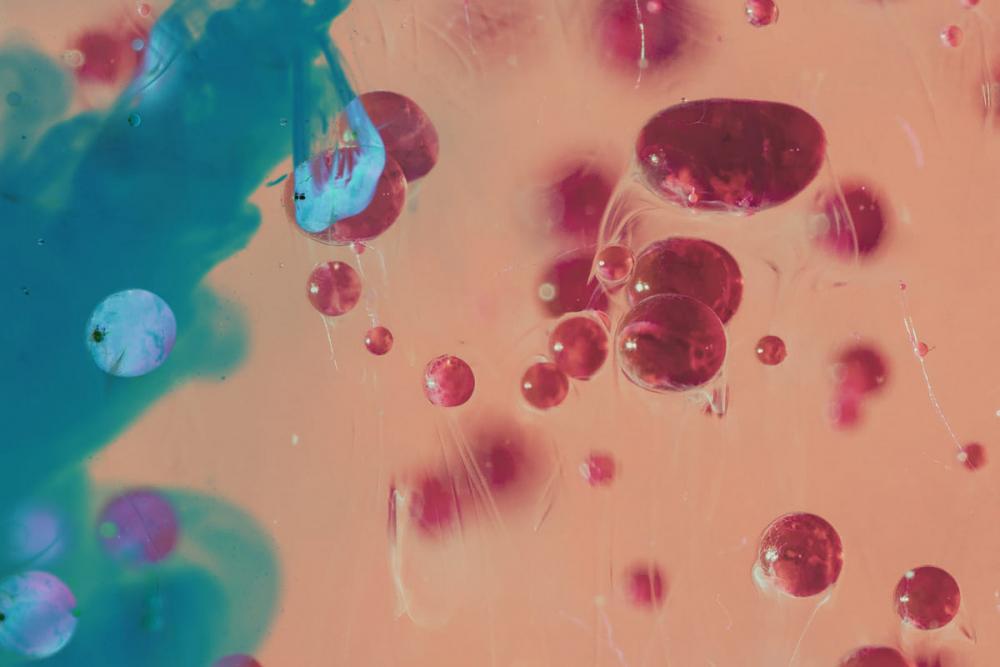 Лимфогранулематоз: это рак или нет?