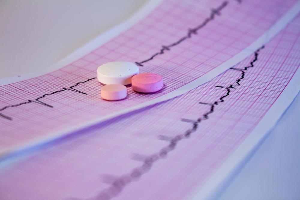 Лечение инфаркта миокарда