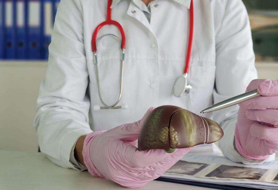 Лечение фиброза печени 3 степени