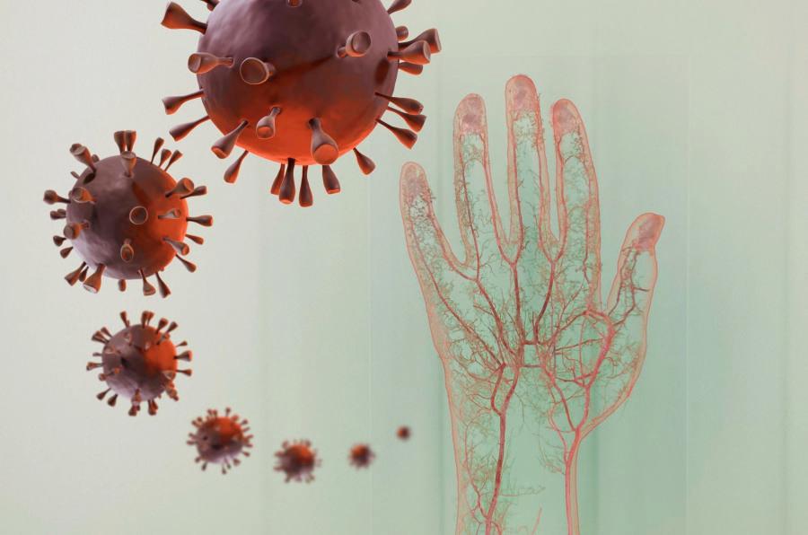 Лимфобластный лейкоз