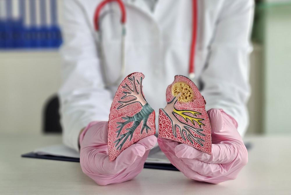 Саркоидоз легких