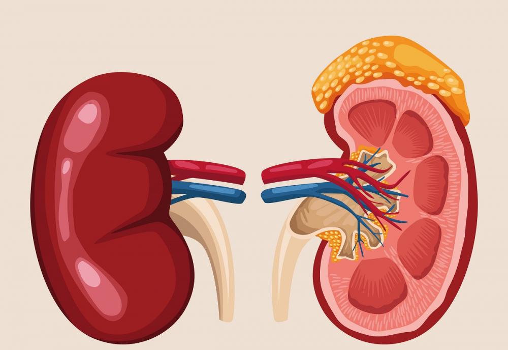 Стеноз почечной артерии
