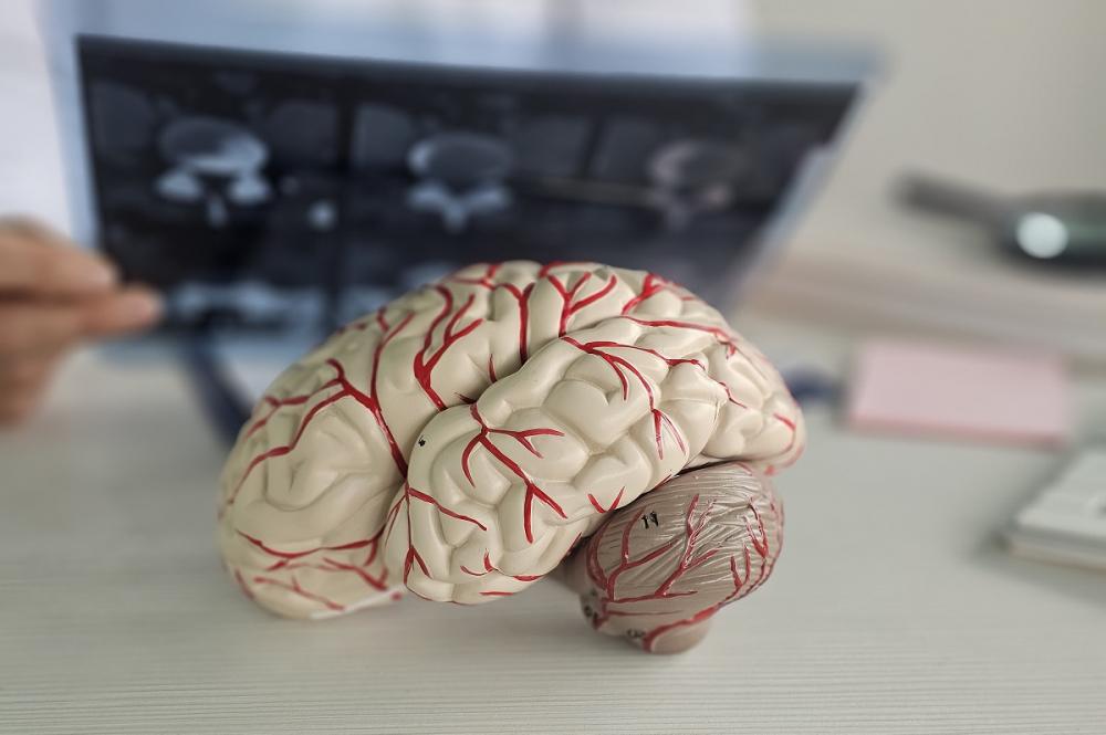 Токсоплазмоз головного мозга