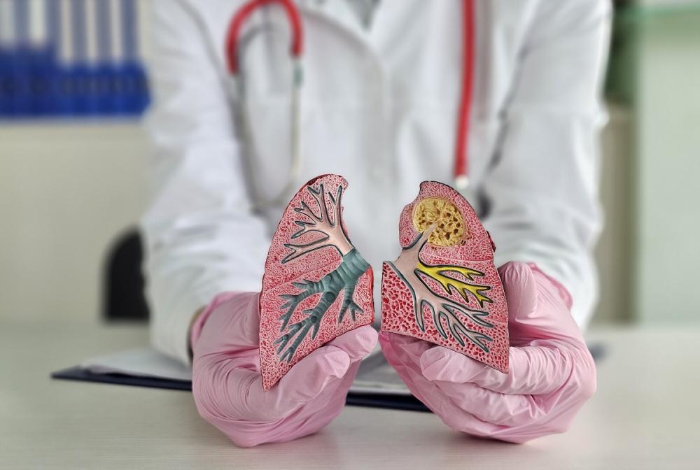 Закрытая форма туберкулеза