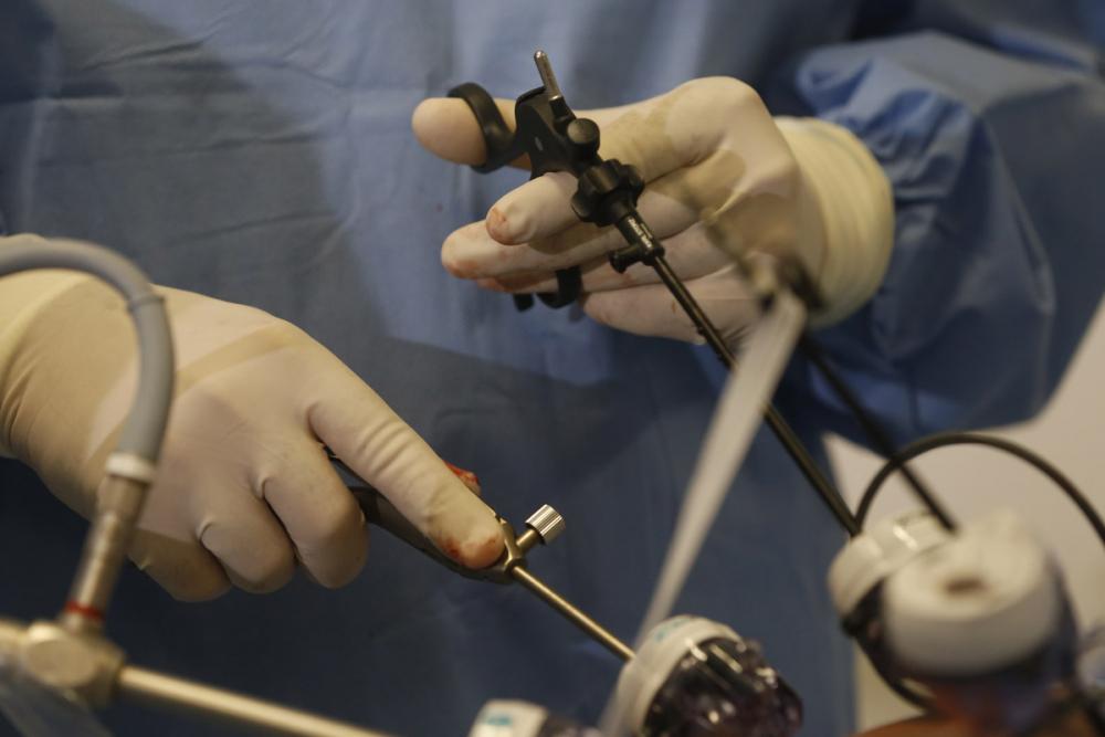 Лапароскопия паховой грыжи