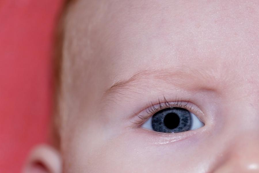 Стеноз слезного канала у ребенка