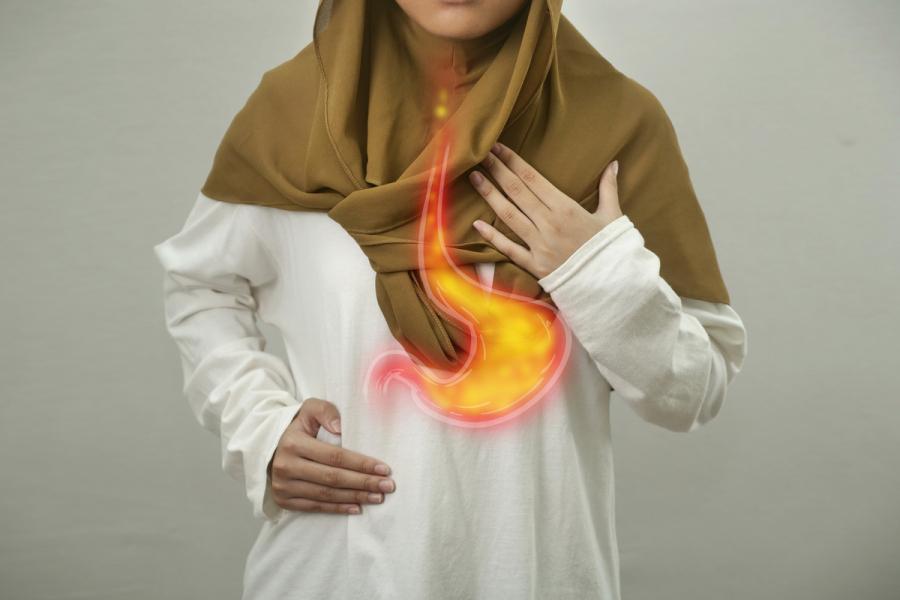 Рефлюкс-гастрит