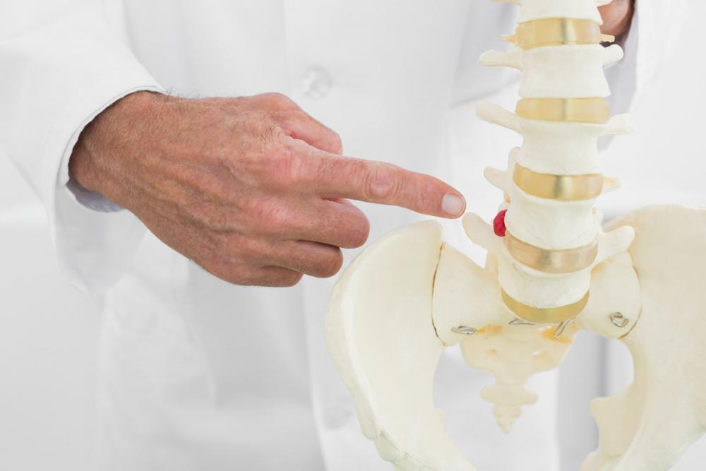 Грыжа диска L5-S1: все о ней