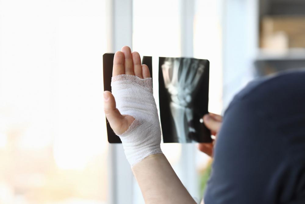 Открытый перелом