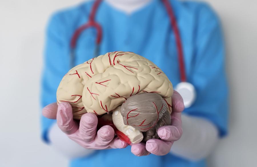 Киста мозжечка головного мозга