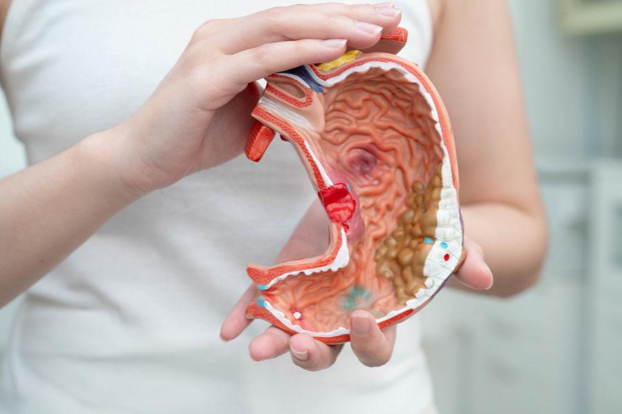 Лечение эрозивного антрального гастрита