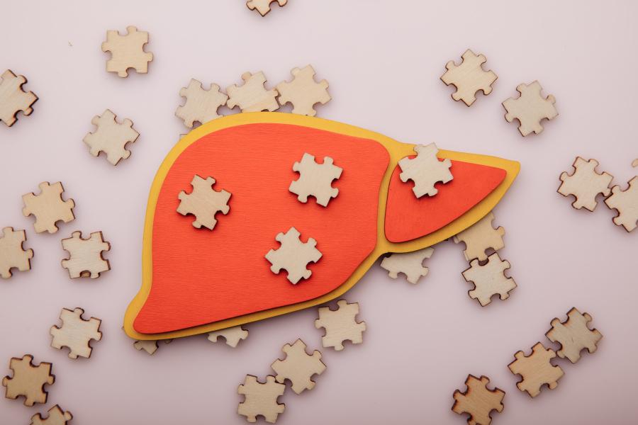 Цирроз печени