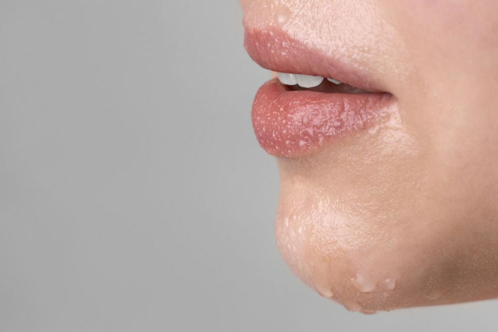 Сифилис на губах