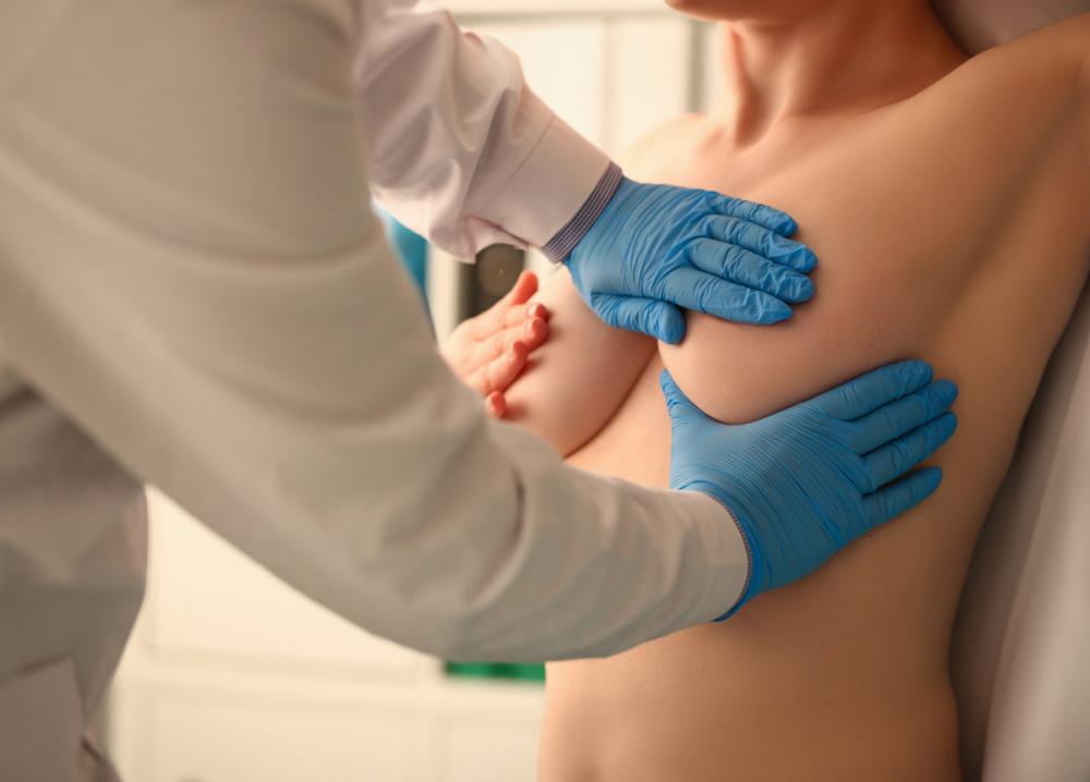 Солитарная киста молочной железы