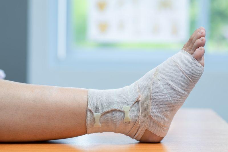 Перелом лодыжки
