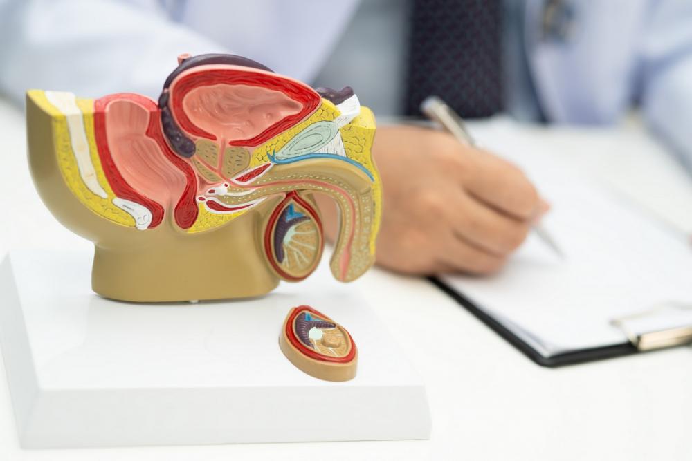 Киста предстательной железы