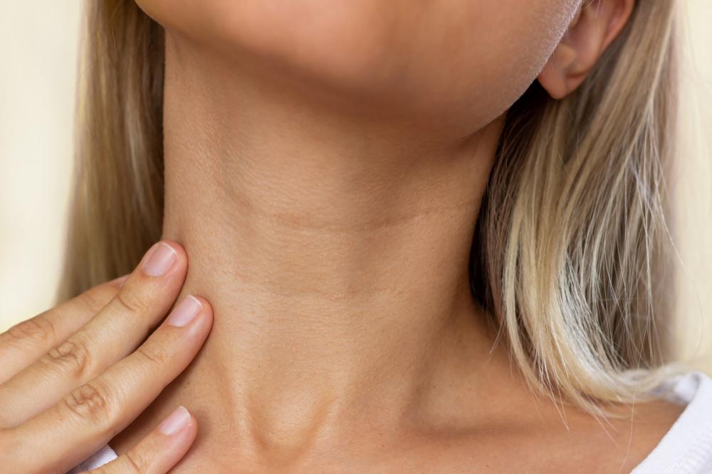 Фиброма лимфоузла на шее