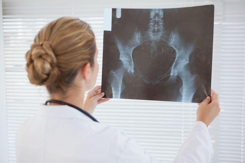 Лечение коксартроза тазобедренного сустава 2 степени