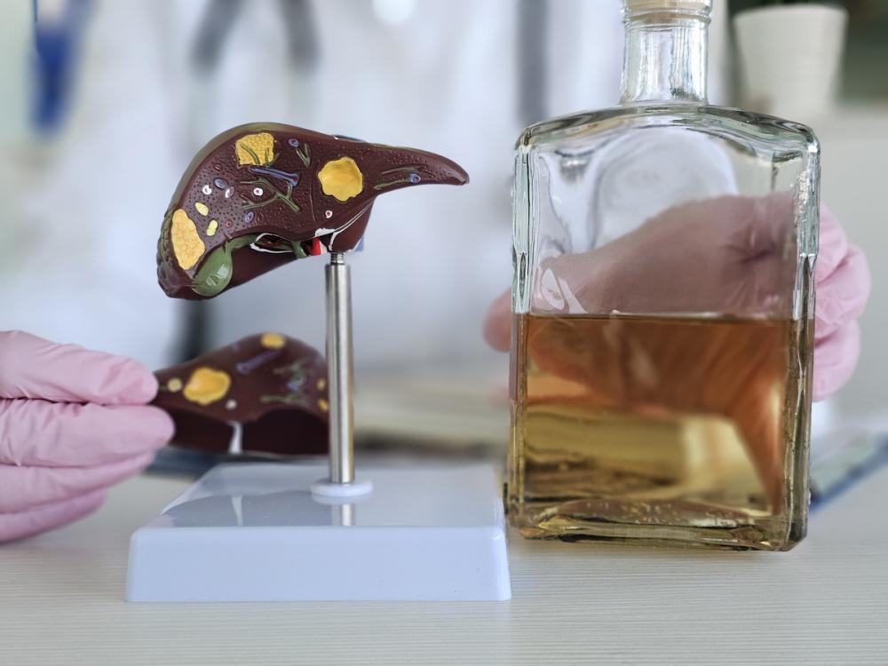 Алкогольный цирроз печени