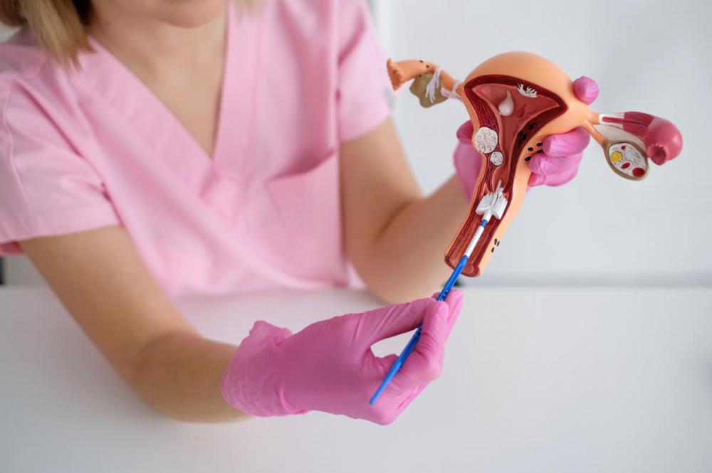 Многокамерная киста яичника