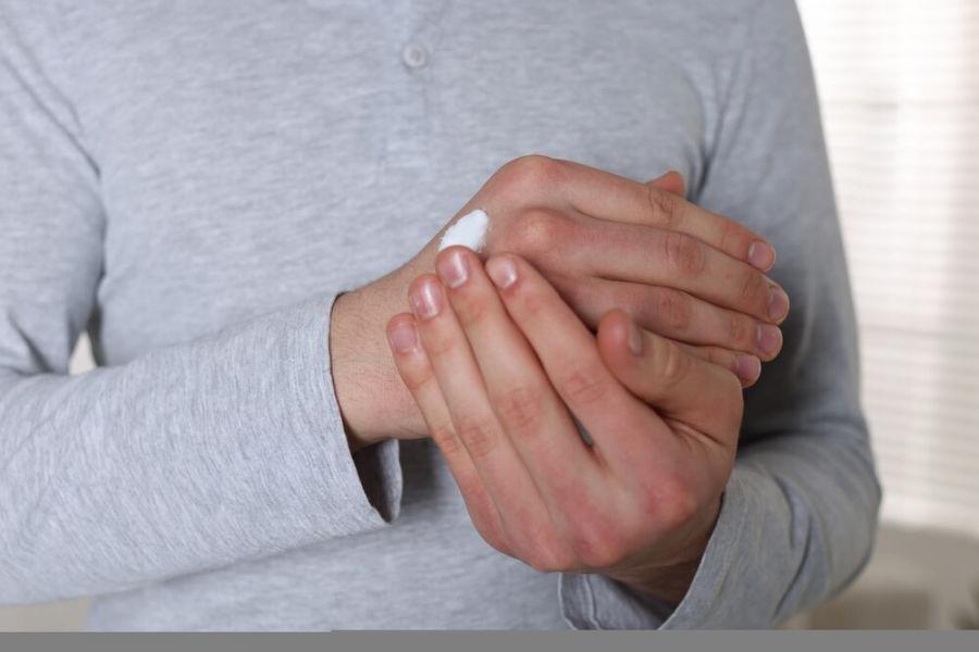 Грибок на руках