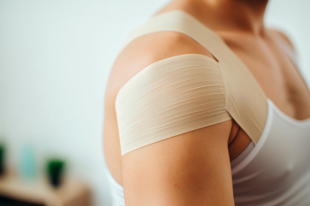 Перелом ключицы