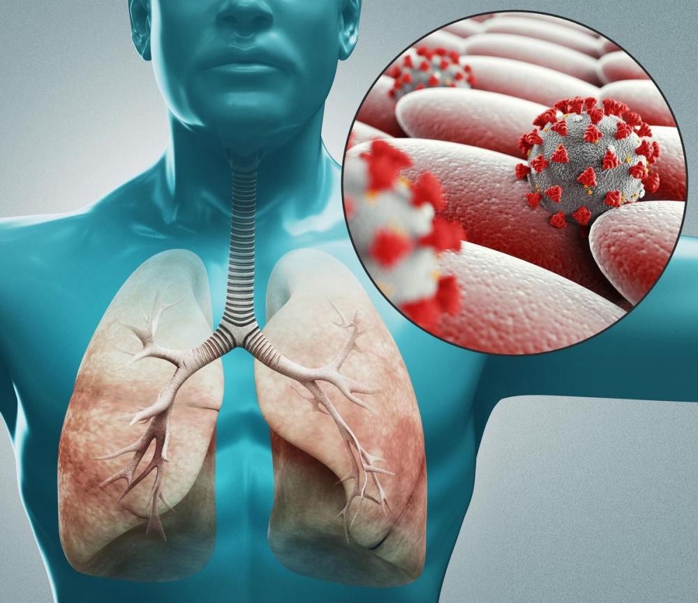 Туберкулез: симптомы и первые признаки