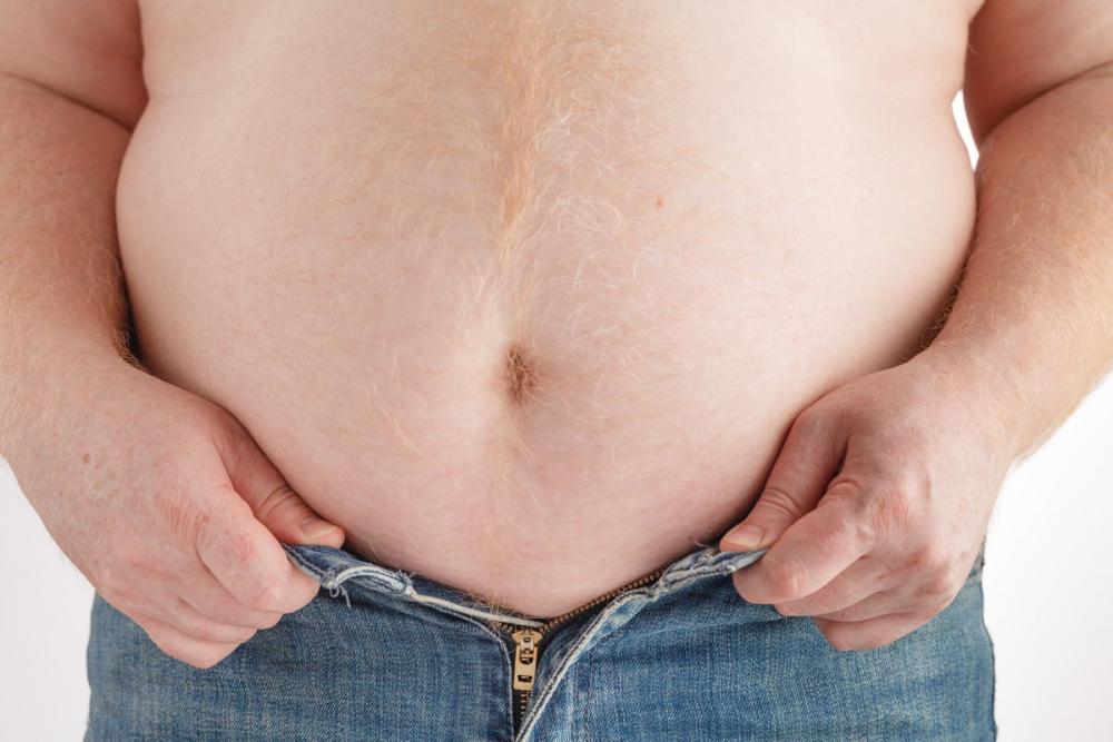 Абдоминальное ожирение