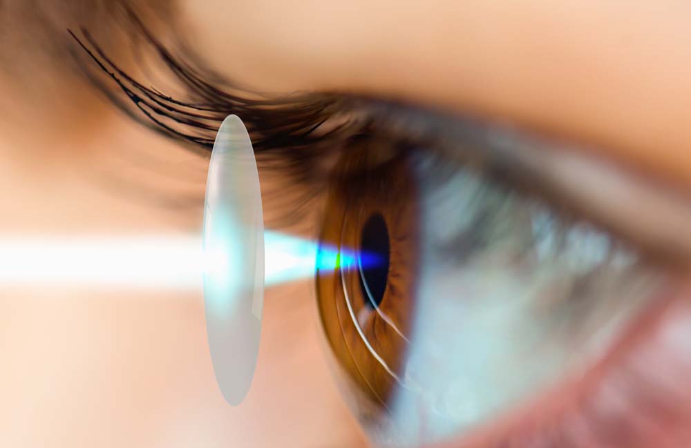 Коррекция зрения LASIK Коррекция зрения LASIK