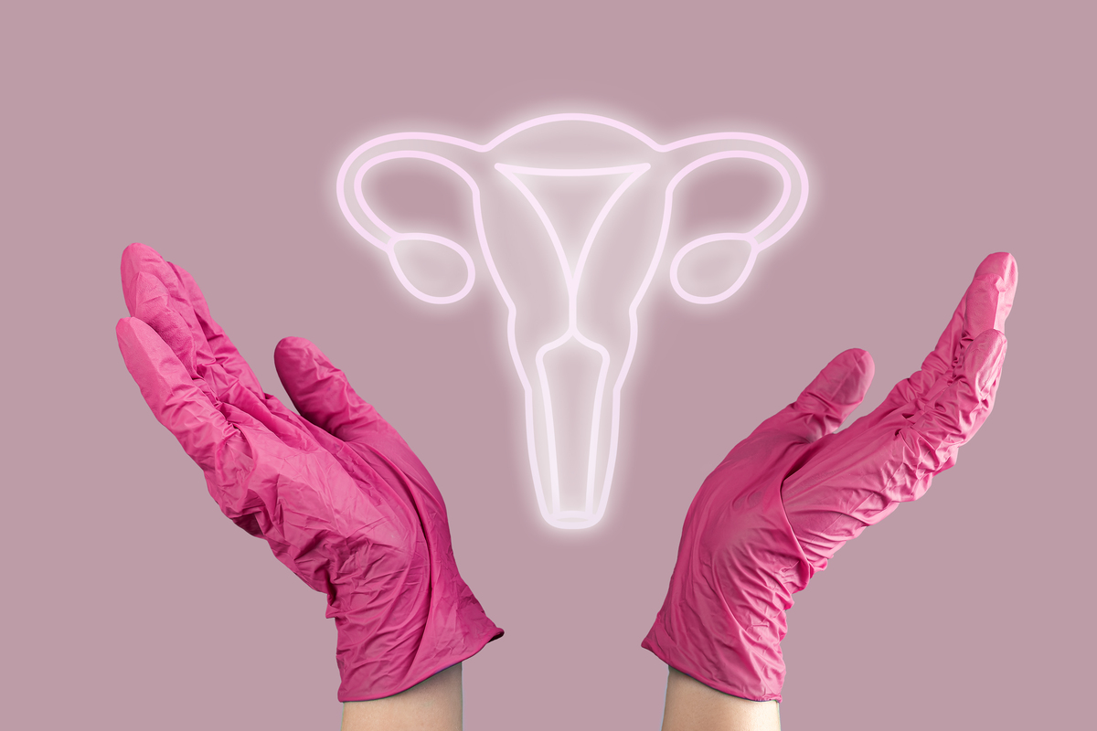 Эндометриоз: формы и стадии заболевания