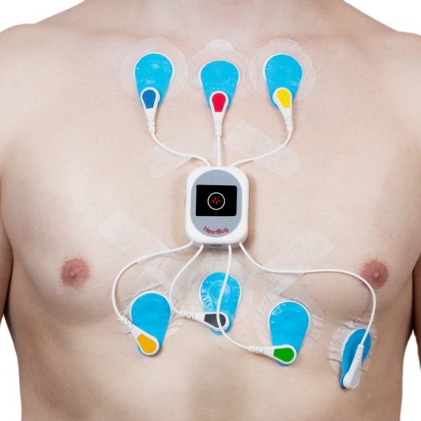 Холтер экг диагностический центр - фото презентация