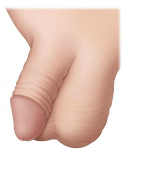 Циркумцизия обрезание после