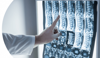 МРТ позвоночника с контрастом