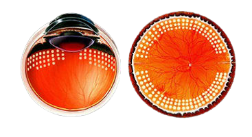 Преимущества лазерной коагуляции Преимущества лазерной коагуляции