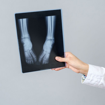 Рентген стопы в Москве