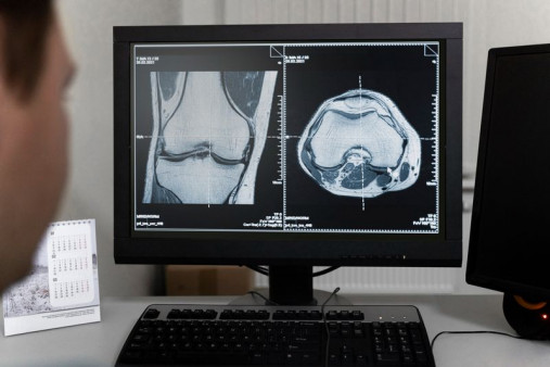 Что показывает томограмма после прохождения процедуры МРТ коленного сустава Что показывает МРТ коленного сустава