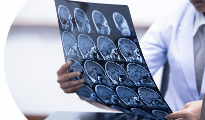 Рентген черепа