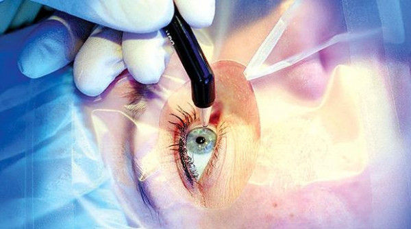 Преимущества проведения лазерной коагуляции сетчатки в «Открытой клинике» Преимущества проведения лазерной коагуляции сетчатки в «Открытой клинике»