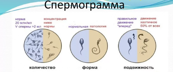 Спермограмма результаты Спермограмма результаты