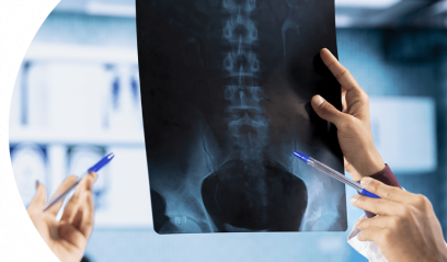 Рентген позвоночника