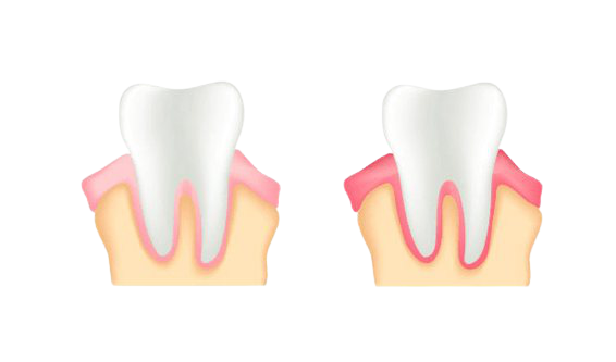 3,539 Gingivitis стоковые фото - бесплатные и стоковые фото RF от Dreamstime - С