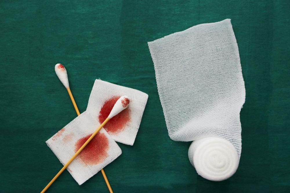 Кровь из носа у ребенка ночью