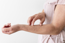 Покраснение и шелушение кожи на руках