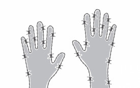 Покалывание в руках