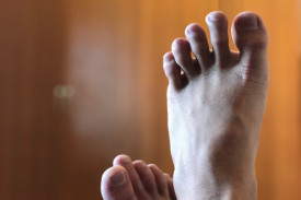 Потемнение пальца ноги