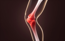 Боль в колене при приседании и вставании - что делать?